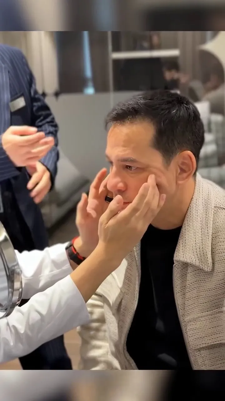 Ari Wibowo operasi antiaging di Korea Selatan © 2025 Instagram Ari Wibowo operasi antiaging di Korea Selatan © 2025 Instagram