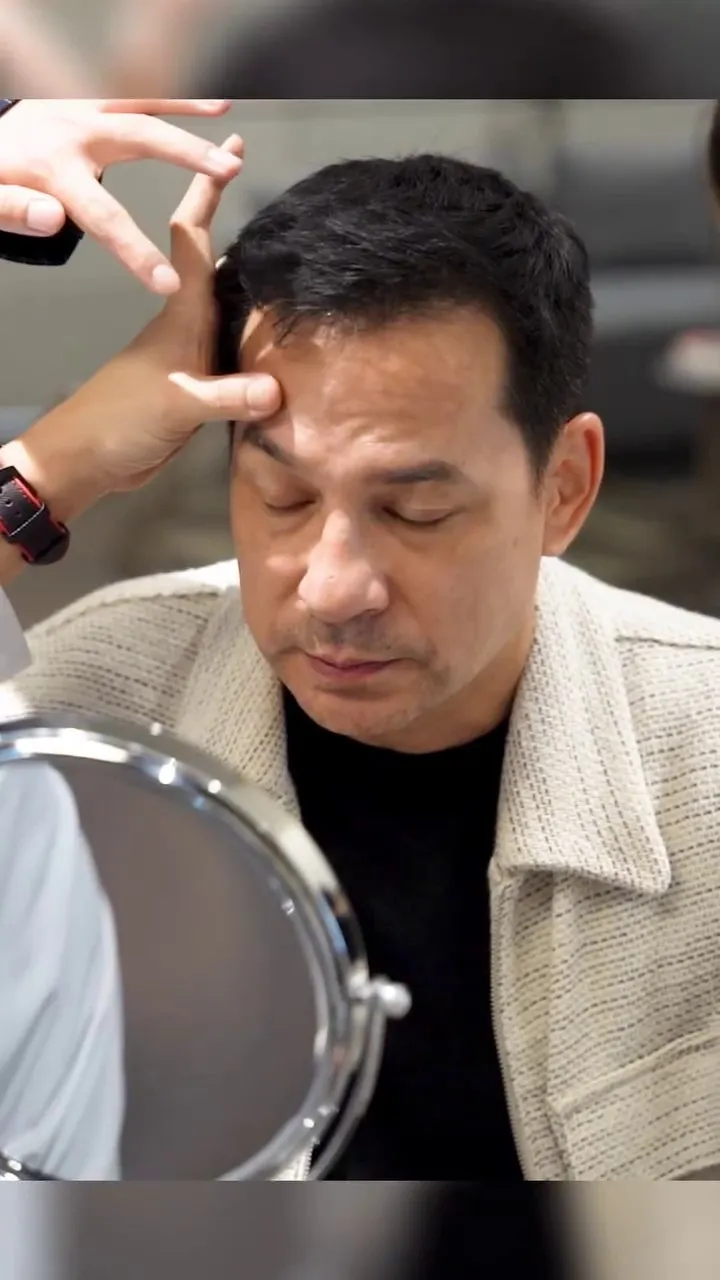 Ari Wibowo operasi antiaging di Korea Selatan © 2025 Instagram Ari Wibowo operasi antiaging di Korea Selatan © 2025 Instagram