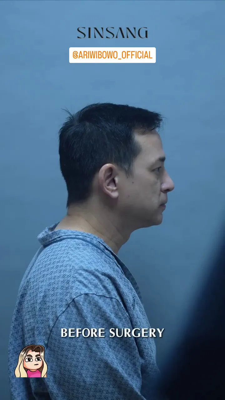 Ari Wibowo operasi antiaging di Korea Selatan © 2025 Instagram Ari Wibowo operasi antiaging di Korea Selatan © 2025 Instagram