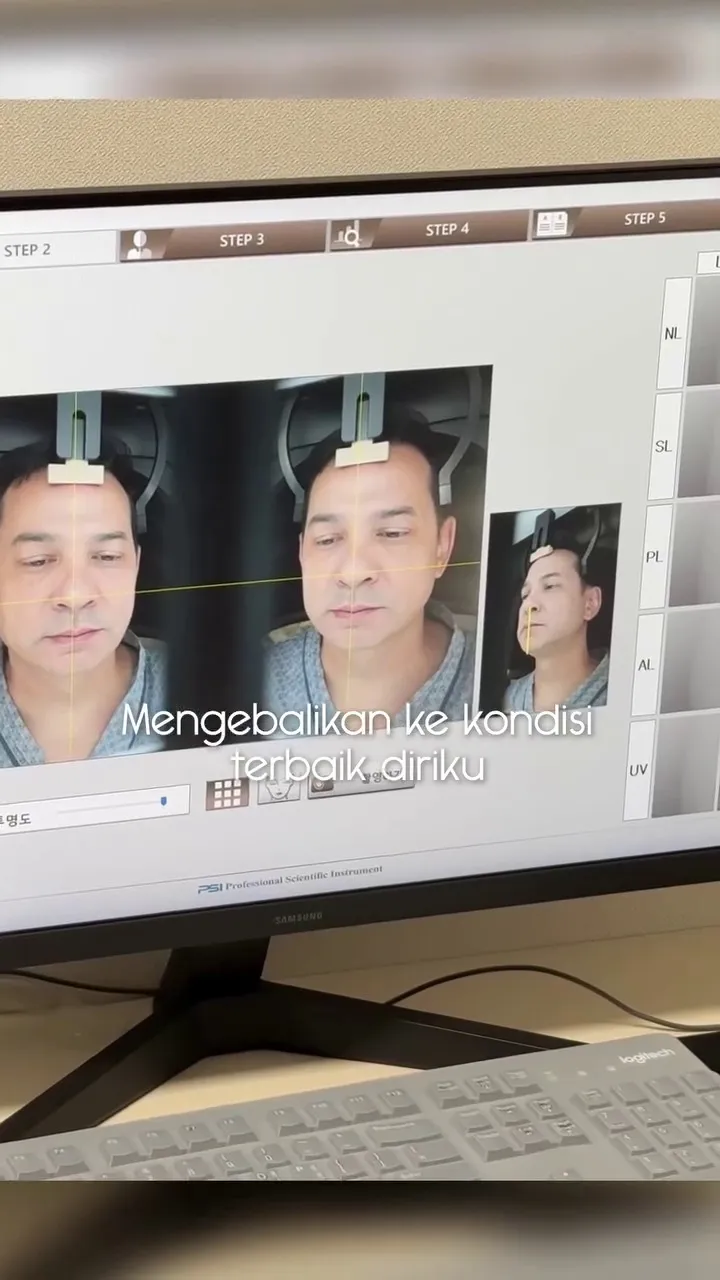 Ari Wibowo operasi antiaging di Korea Selatan © 2025 Instagram Ari Wibowo operasi antiaging di Korea Selatan © 2025 Instagram