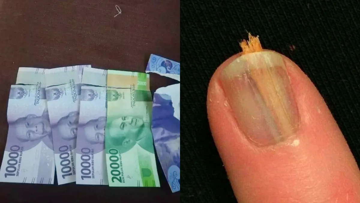 Bagai sakit tapi tak berdarah, ini 11 momen apes bisa dirasakan, antara pedih dan nyesek