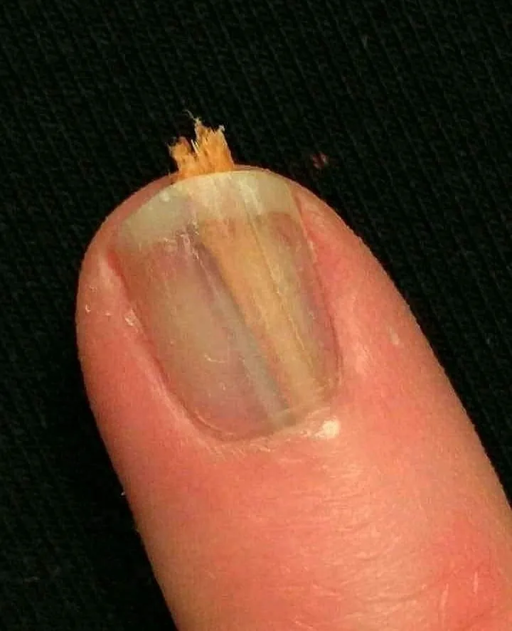 momen apes bisa dirasakan © berbagai sumber momen apes bisa dirasakan © berbagai sumber