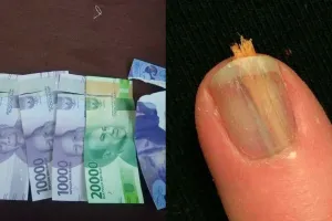 Bagai sakit tapi tak berdarah, ini 11 momen apes bisa dirasakan, antara pedih dan nyesek