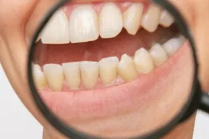 Hilangkan plak kuning dan bau mulut tanpa lemon maupun garam, begini trik mudahnya