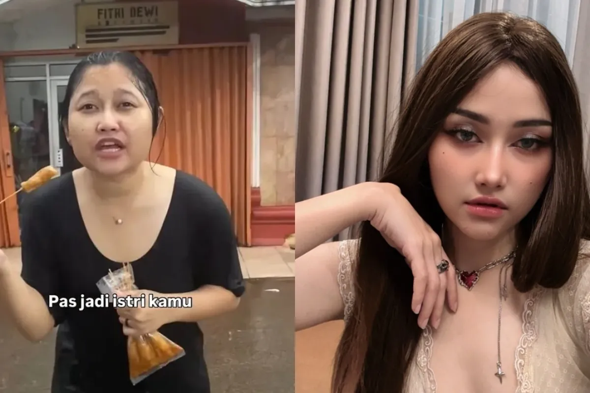 Wajah berubah 180 derajat, 7 potret before-after selebgram usai oplas, Wendy Walter perbaiki hidung