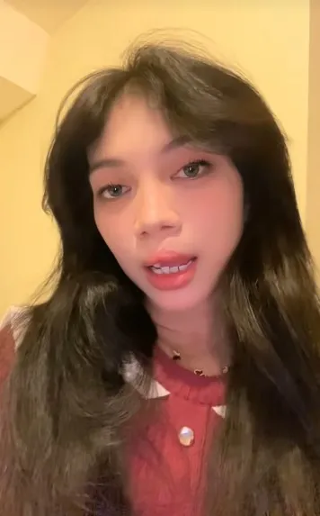 gadis bibir sumbing dioperasi gratis Dokter Tompi © TikTok