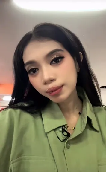 gadis bibir sumbing dioperasi gratis Dokter Tompi © TikTok