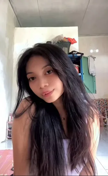 gadis bibir sumbing dioperasi gratis Dokter Tompi © TikTok