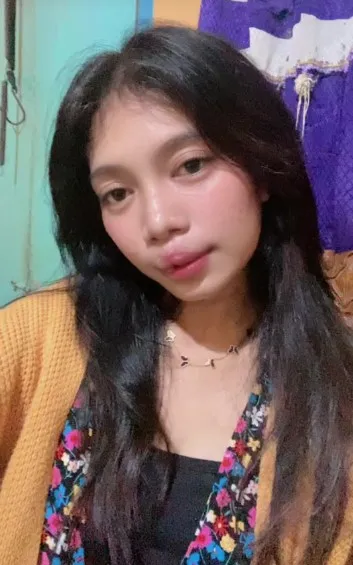 gadis bibir sumbing dioperasi gratis Dokter Tompi © TikTok