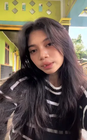 gadis bibir sumbing dioperasi gratis Dokter Tompi © TikTok