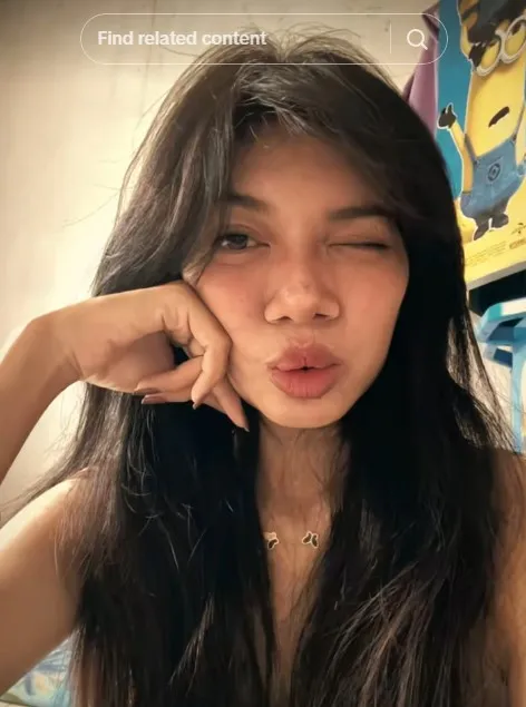 gadis bibir sumbing dioperasi gratis Dokter Tompi © TikTok