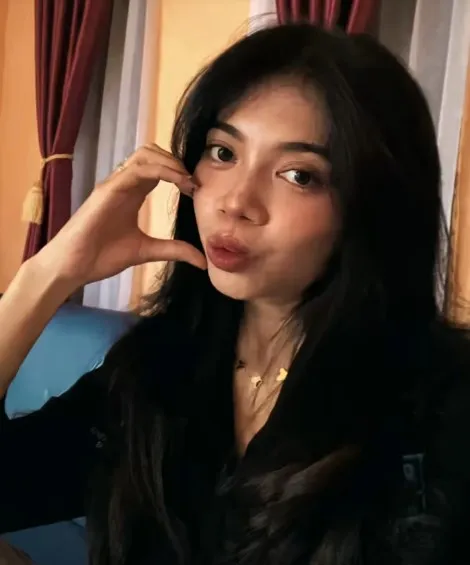 gadis bibir sumbing dioperasi gratis Dokter Tompi © TikTok