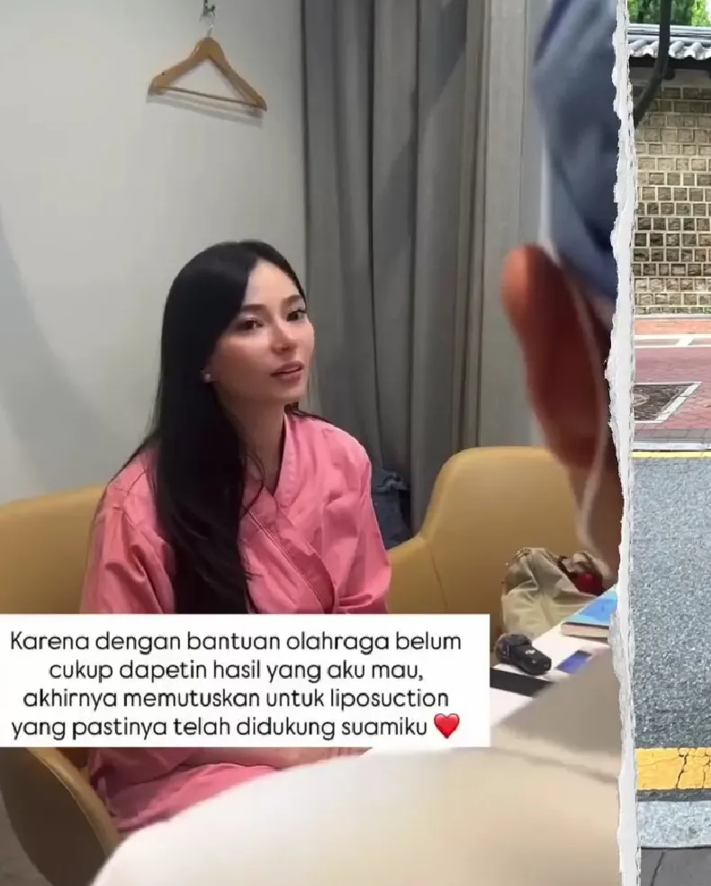 Asmirandah putuskan sedot lemak © Instagram Asmirandah putuskan sedot lemak © Instagram