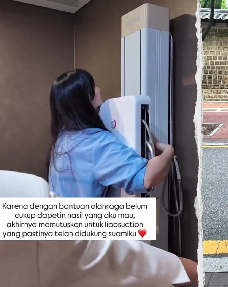 Asmirandah putuskan sedot lemak © Instagram Asmirandah putuskan sedot lemak © Instagram