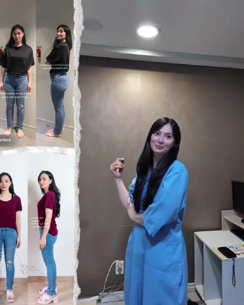 Asmirandah putuskan sedot lemak © Instagram Asmirandah putuskan sedot lemak © Instagram