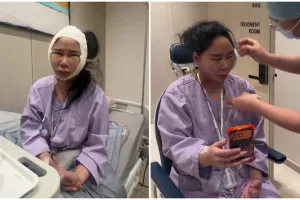 7 Potret Denise Chariesta jalani oplas wajah di Korea Selatan, ngaku habiskan dana Rp1 miliar