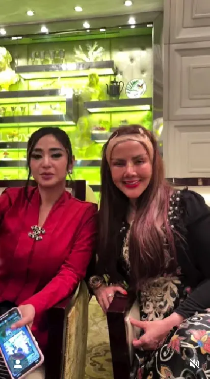 Barbie Kumalasari operasi plastik 8 kali © Instagram