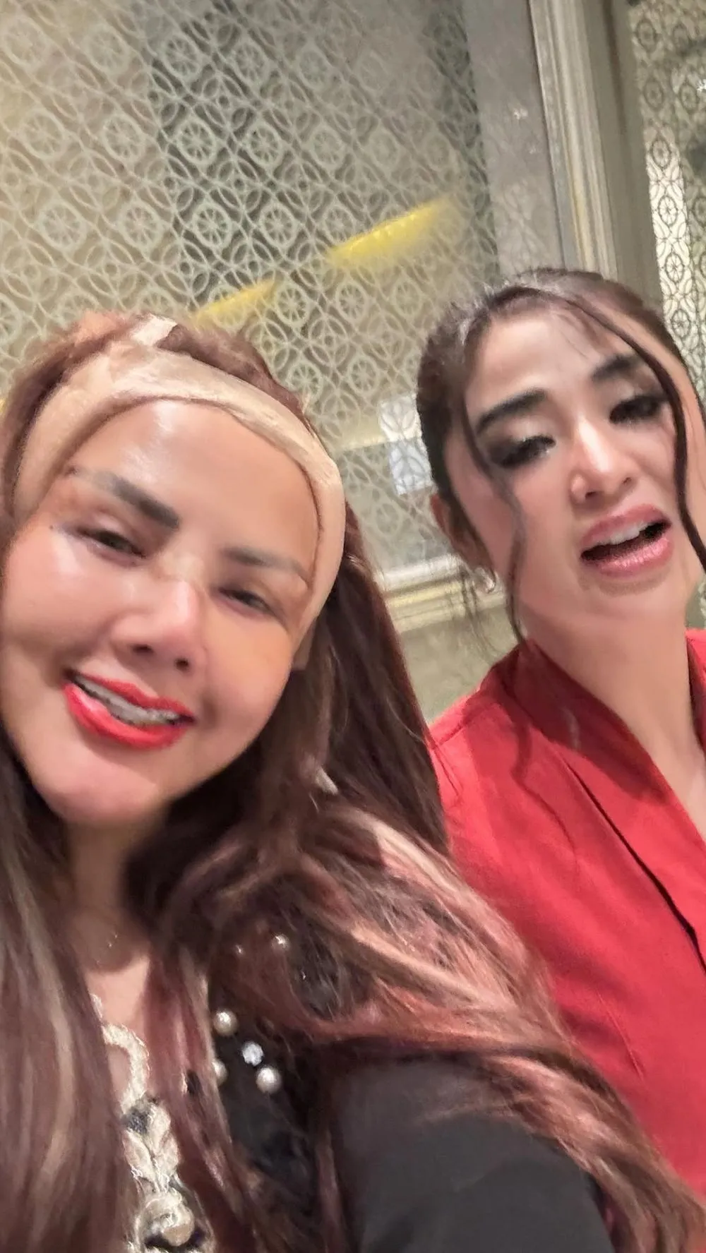 Barbie Kumalasari operasi plastik 8 kali © Instagram