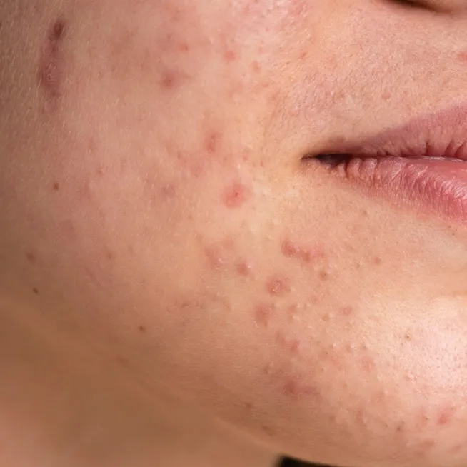 Kulit belang dan kusam? Coba trik cerahkan wajah cuma pakai 1 jenis tepung, hasilnya bikin kaget