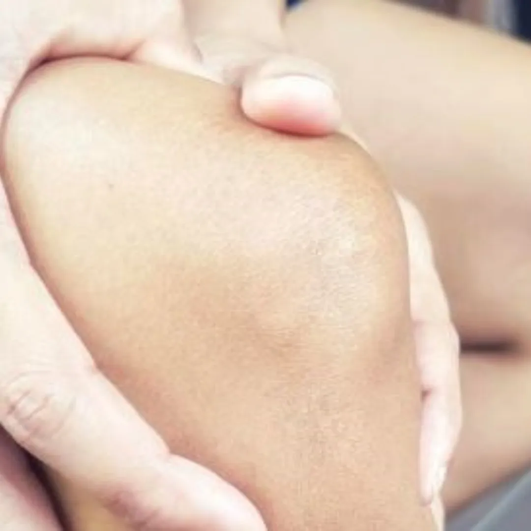 Cerah merata tanpa kunyit, ini rahasia scrub buah alami yang ampuh samarkan siku dan lutut hitam