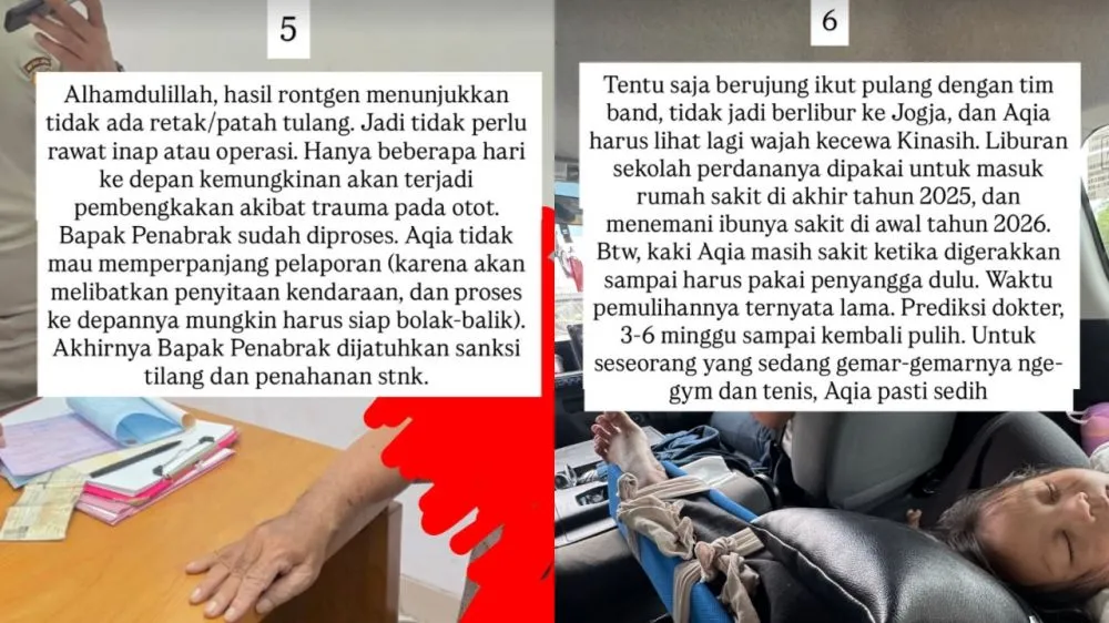 Istri Fiersa Besari Kecelakaan Instagram @fiasabesari