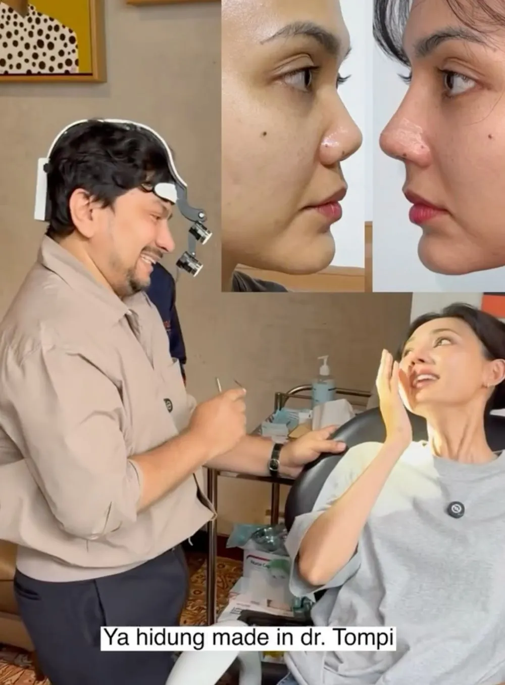 Rina Nose Operasi Hidung Instagram/@rinanose16 Rina Nose Operasi Hidung Instagram/@rinanose16