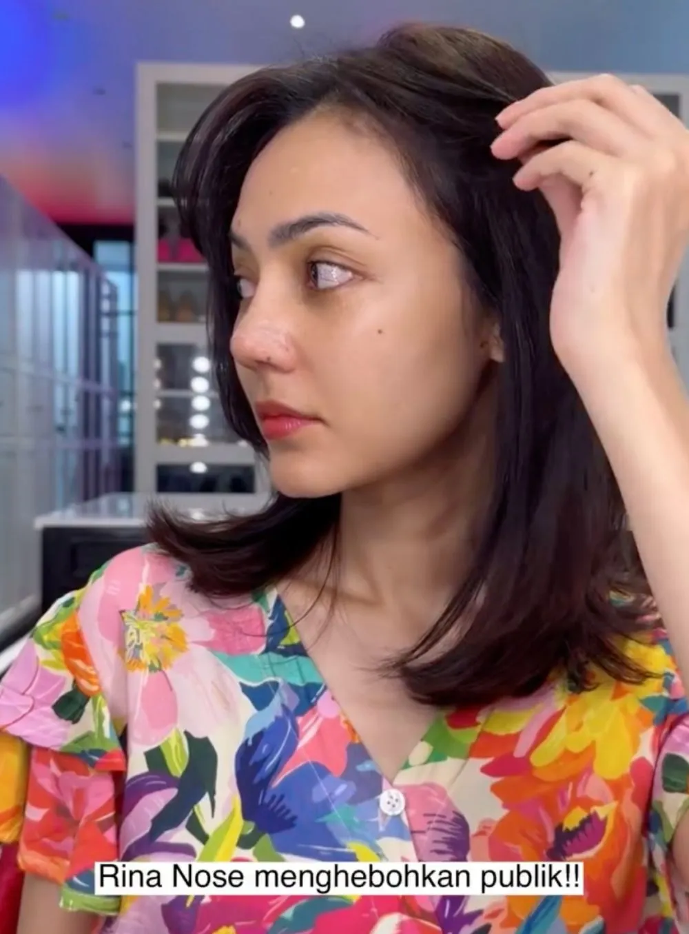 Rina Nose Operasi Hidung Instagram/@rinanose16 Rina Nose Operasi Hidung Instagram/@rinanose16