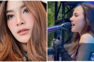 Bentuk wajah berubah drastis sampai tak dikenali, ini potret 8 penyanyi solo usai operasi hidung