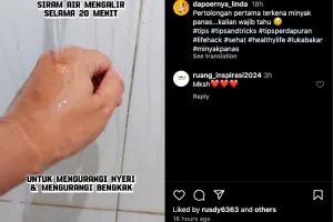 Bukan dioles pasta gigi, ini cara atasi kulit terkena minyak panas agar tak melepuh pakai 1 jenis buah