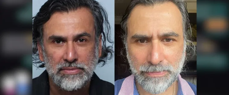 Bukan untuk awet muda tapi jaga penampilan di usia 50-an, 7 potret terbaru Jeremy Thomas usai facelift