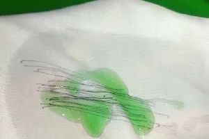 Tak perlu tenaga ekstra, ini trik basmi coretan pulpen di baju putih agar kinclong pakai 2 bahan dapur