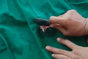 Bukan diolesi minyak, ini trik menghilangkan permen karet di pakaian tanpa bekas pakai 1 bahan makanan