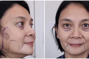 11 Potret Dian Nitami sebulan usai operasi face lifting, puas kulitnya kencang tak mengubah wajah
