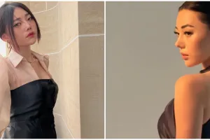 9 Penampilan terbaru Wendy Walters usai oplas hidung, bentuknya malah jadi bikin salfok