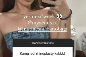 Sudah jadi impiannya sejak SMP, ini 7 potret Shafa Harris jalani oplas hidung di Korea Selatan