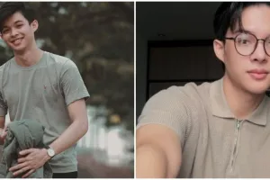 Putuskan oplas hidung karena masalah kesehatan, ini 9 transformasi Rey Mbayang bikin salfok