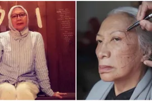 Perbaiki wajah di usia 75 tahun, ini 7 momen Ratna Sarumpaet jalani 5 prosedur oplas di dokter Tompi