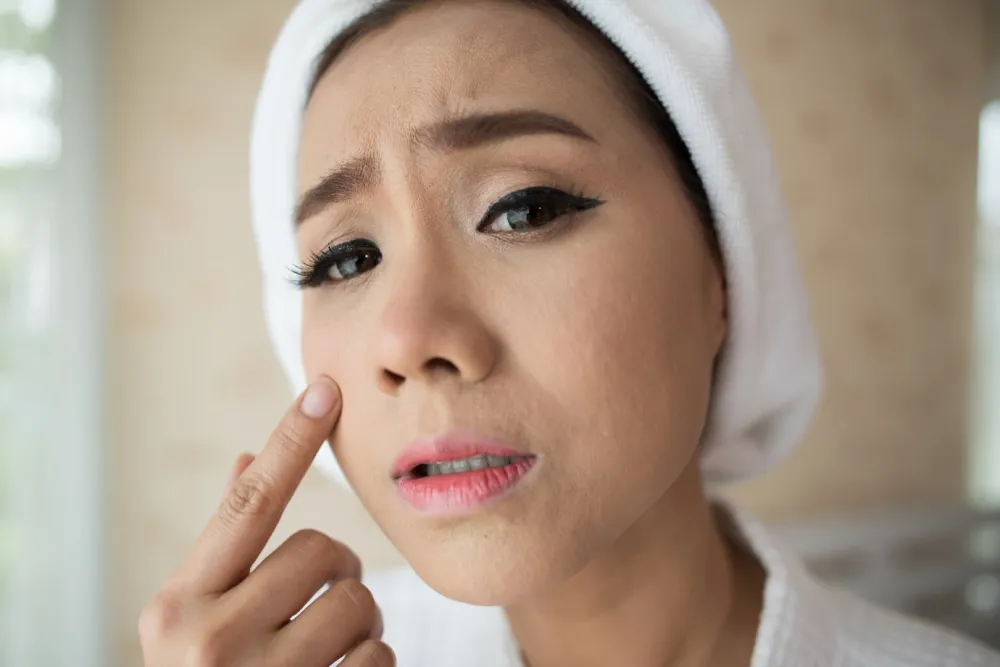 Efek samping jeruk lemon untuk wajah © Efek samping jeruk lemon untuk wajah ©