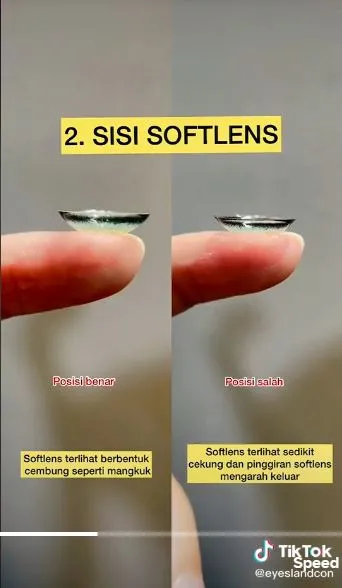 cara membedakan softlens terbalik atau tidak berbagai sumber