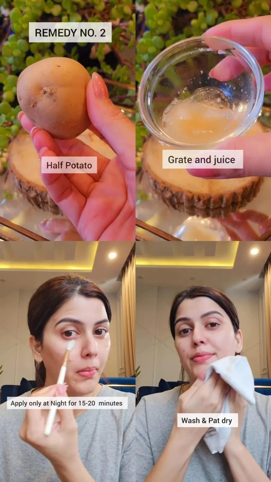 garis halus dan pigmentasi © Instagram