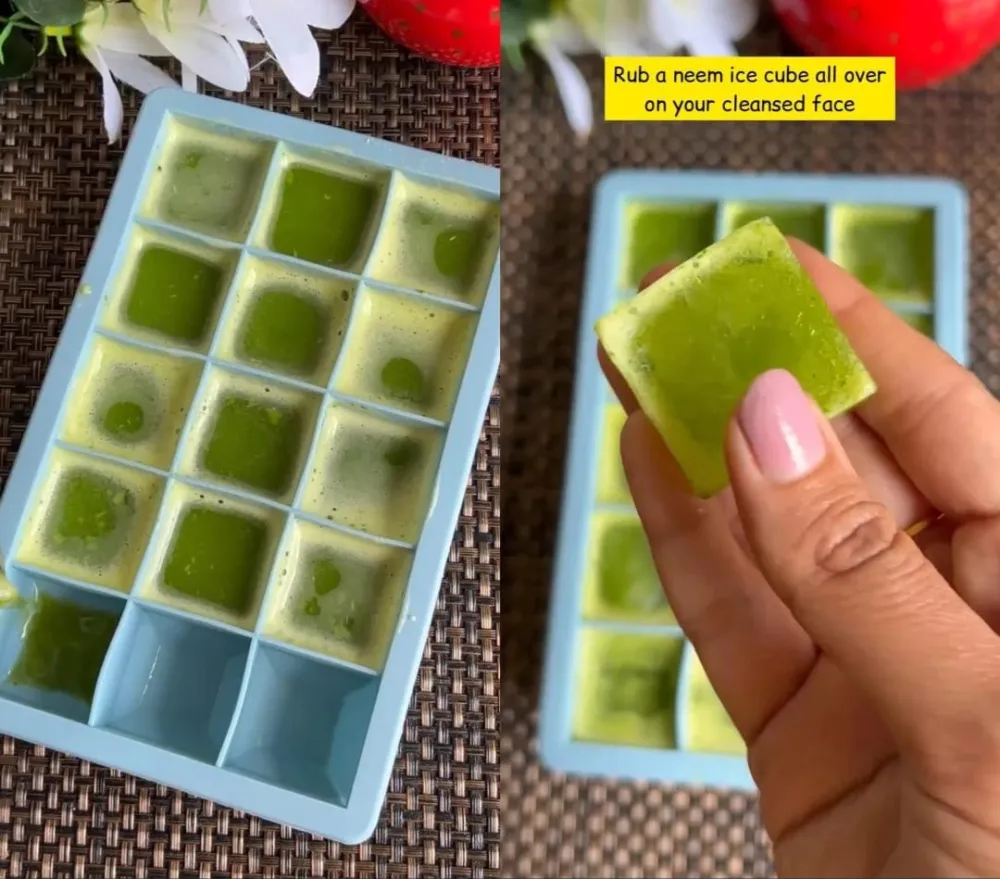 hilangkan jerawat agar tidak berbekas © Instagram