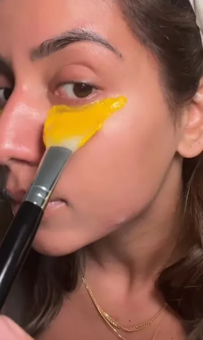 Atasi dark circle dan kantung mata pakai 1 bahan pemanis Berbagai sumber