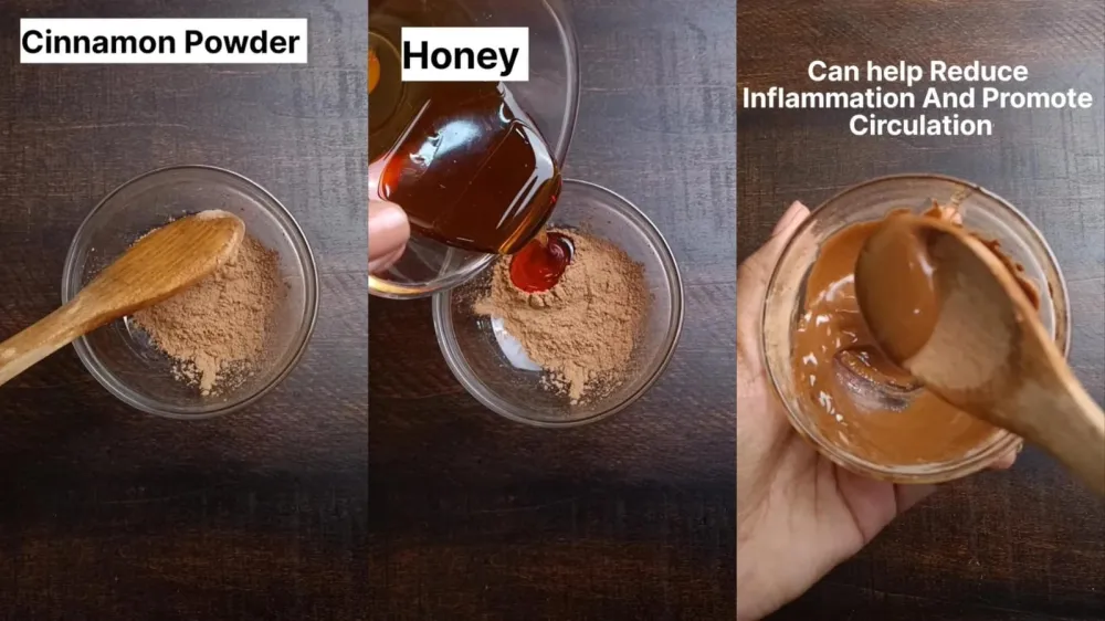 kurangi munculnya jerawat dan bekasnya © Instagram