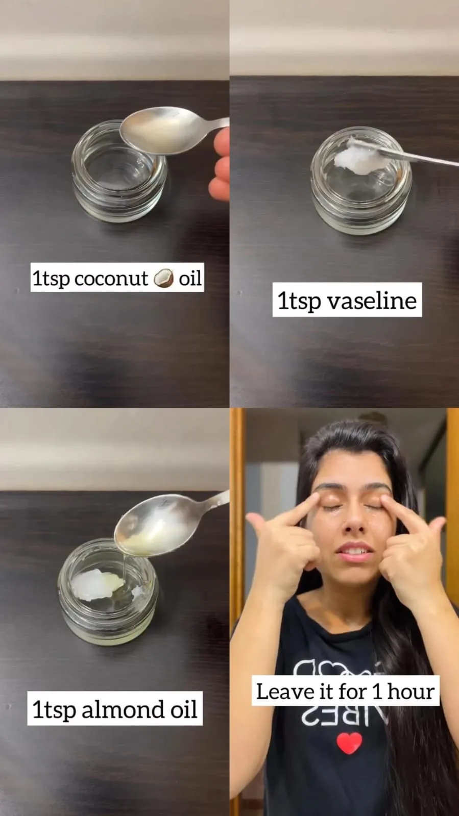 kerutan dan lingkaran hitam di bawah mata © Instagram