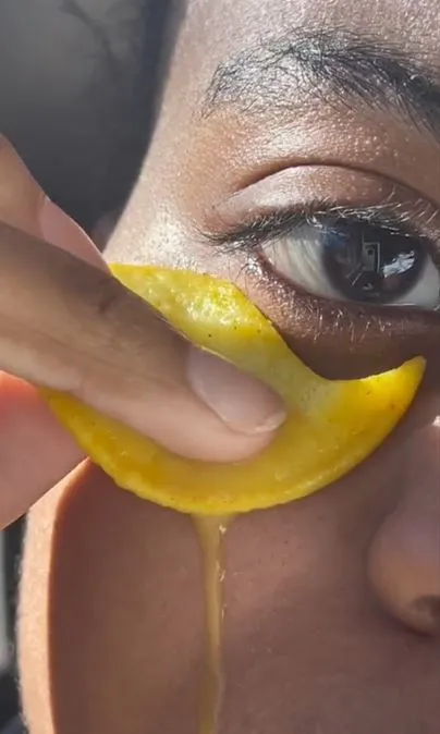 Memutihkan kulit bawah mata dengan 3 bahan dapur Berbagai sumber Memutihkan kulit bawah mata dengan 3 bahan dapur Berbagai sumber