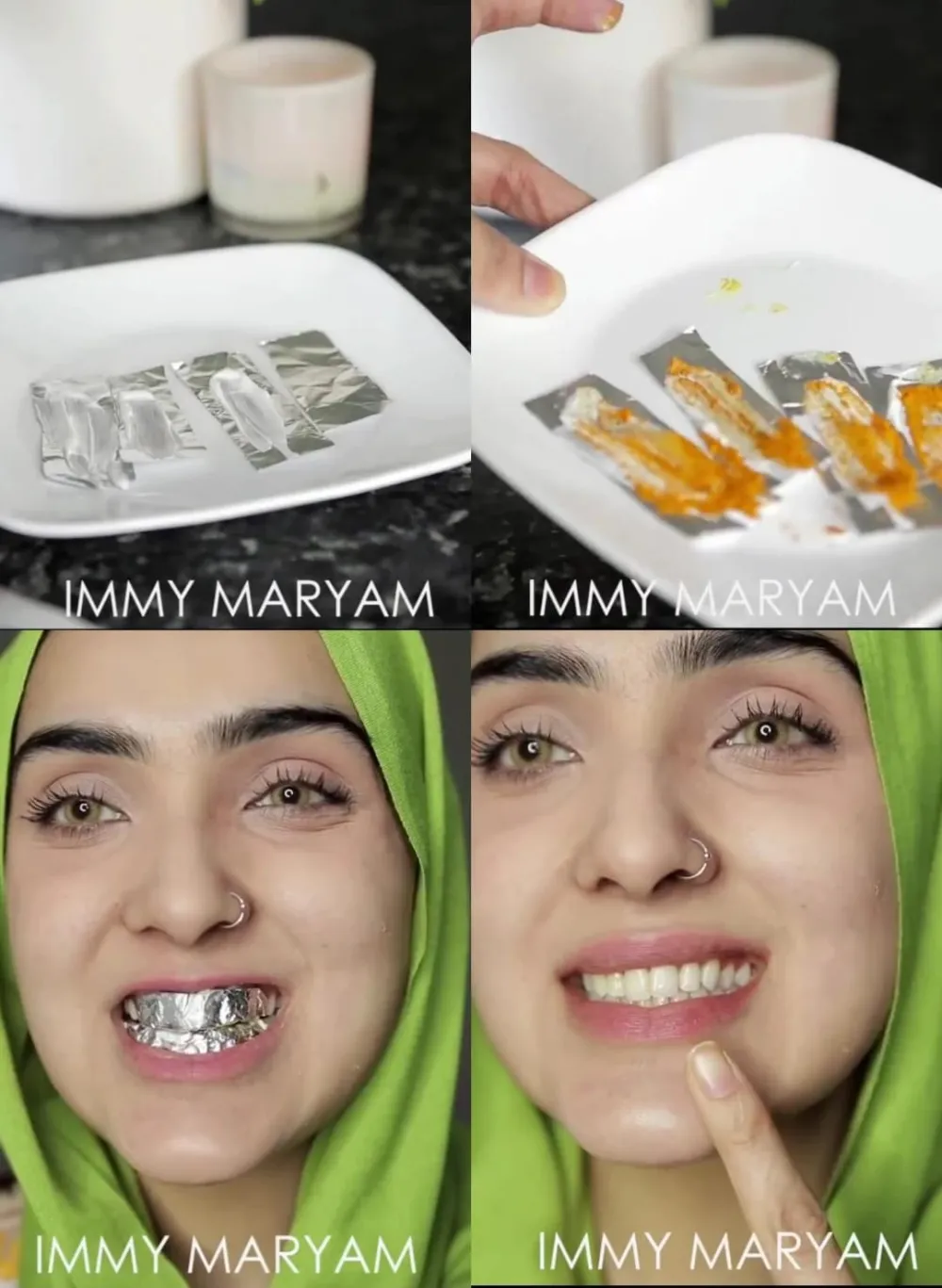 putihkan gigi kuning penuh plak © Instagram