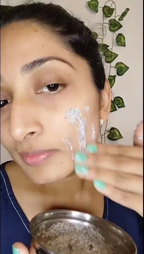 atasi jerawat dan bekasnya berbagai sumber