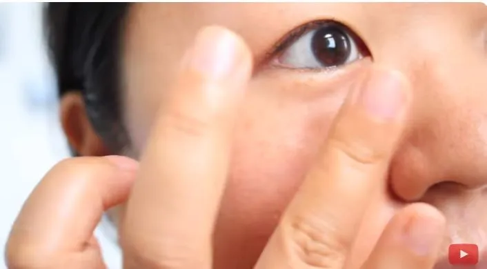 atasi kantung mata berbagai sumber atasi kantung mata berbagai sumber