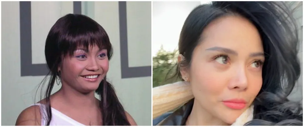 mawar afi sebelum dan sesudah operasi plastik © berbagai sumber