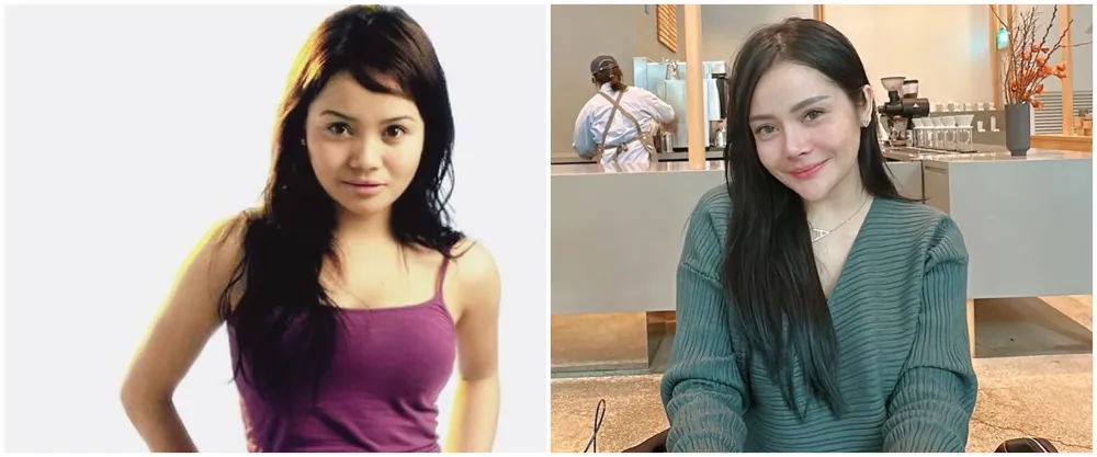 mawar afi sebelum dan sesudah operasi plastik © berbagai sumber